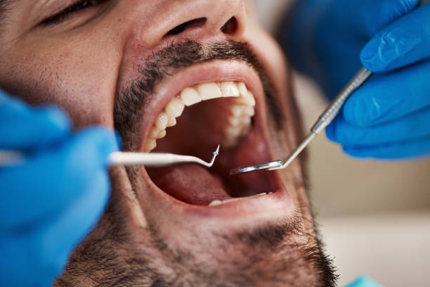 Best After-Hours Emergency Dentist in Allentown, NJ