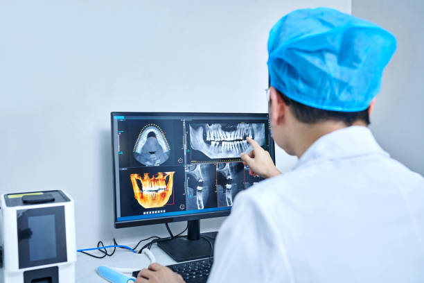 Best Emergency Wisdom Teeth Removal in Allentown, NJ